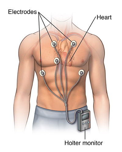 Components of an ecg machine, 