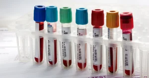 How to Improve Lab Efficiency with a Hematology Analyzer