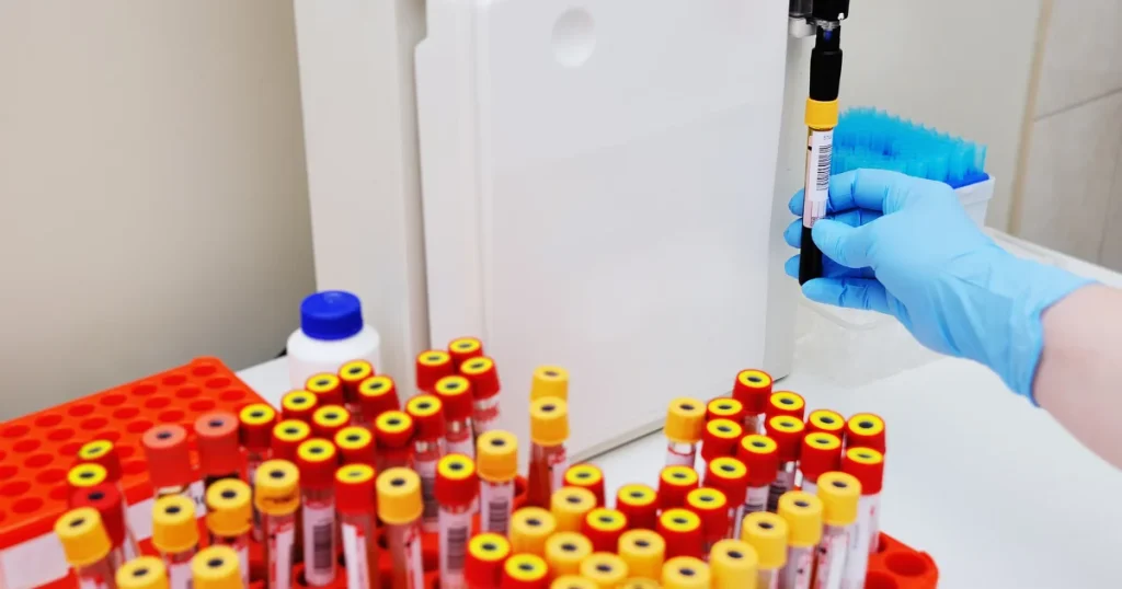 Electrolyte Analyzers 101 The Ultimate Guide