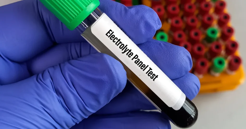 Types of Electrolyte Analyzers – Finding Your Perfect Match